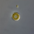 Choanocystis aculeata 63xc