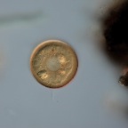 Arcella vulgaris (1)